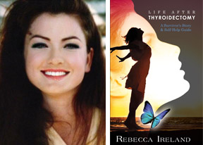 Rebecca Ireland Life After Thyroidectomy